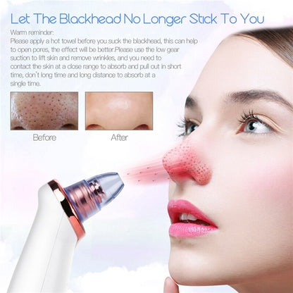 PoreVac Blackhead Remover