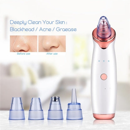 PoreVac Blackhead Remover